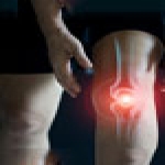 3 Things to try before Knee Replacement Surgery