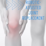 Benefits of Robotic Knee Replacement