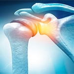 What Causes Rotator Cuff Problems?