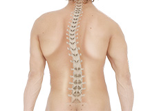 Kyphosis in Children